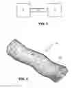 Fig. 02 - Air delivery conduit