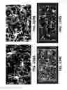 Fig. 125 - Systems and methods for treating dementia