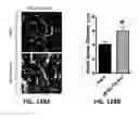Fig. 129 - Systems and methods for treating dementia