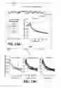 Fig. 14 - Systems and methods for treating dementia