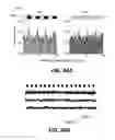 Fig. 45 - Systems and methods for treating dementia