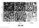Fig. 65 - Systems and methods for treating dementia