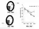 Fig. 80 - Systems and methods for treating dementia