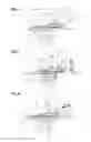 Fig. 06 - Catheter anchoring device