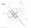 Fig. 10 - Catheter anchoring device