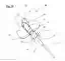 Fig. 11 - Catheter anchoring device