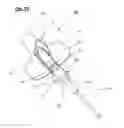 Fig. 12 - Catheter anchoring device