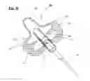Fig. 15 - Catheter anchoring device