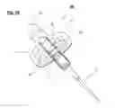 Fig. 16 - Catheter anchoring device