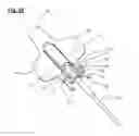 Fig. 19 - Catheter anchoring device