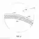 Fig. 03 - Balloon catheter