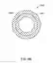 Fig. 11 - Balloon catheter