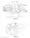 Fig. 15 - Telescopic percutaneous tissue dilation systems and related methods