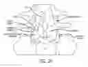 Fig. 16 - Telescopic percutaneous tissue dilation systems and related methods