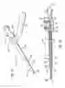 Fig. 20 - Telescopic percutaneous tissue dilation systems and related methods