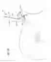 Fig. 29 - Telescopic percutaneous tissue dilation systems and related methods