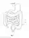 Fig. 02 - DEVICES, SYSTEMS AND METHODS FOR TREATING ULCERATIVE COLITIS AND OTHER INFLAMMATORY BOWEL DISEASES