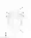 Fig. 34 - Aseptic coupling devices