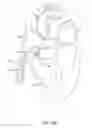 Fig. 19 - Delivery devices and methods for leadless cardiac devices