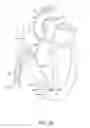 Fig. 21 - Delivery devices and methods for leadless cardiac devices