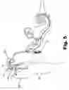 Fig. 06 - Auditory prosthesis system including sound processor apparatus with position sensor