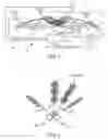 Fig. 02 - Spinal cord stimulation with interferential current