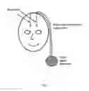 Fig. 02 - CHOLINERGIC DEEP BRAIN STIMULATOR