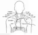 Fig. 01 - Systems and related methods for optimization of multi-electrode nerve pacing