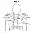 Fig. 02 - Systems and related methods for optimization of multi-electrode nerve pacing