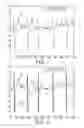 Fig. 04 - Determining onsets and offsets of cardiac depolarization and repolarization waves
