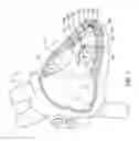 Fig. 02 - Delivery devices and methods for leadless cardiac devices