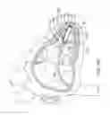 Fig. 13 - Delivery devices and methods for leadless cardiac devices