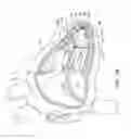 Fig. 15 - Delivery devices and methods for leadless cardiac devices