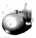 Fig. 43 - Leadless neurostimulator