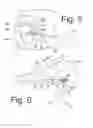Fig. 04 - Method of orthopedic treatment by radiation