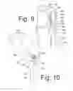 Fig. 06 - Method of orthopedic treatment by radiation
