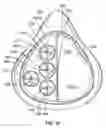 Fig. 13 - RESISTANCE AND FILTRATION BREATHING DEVICE