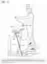 Fig. 13 - Elliptical exercise device with moving control tracks