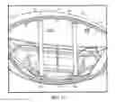 Fig. 16 - Golf Club Head With Structural Columns