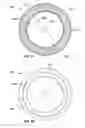 Fig. 11 - Filter sealing assembly and filtration vessel