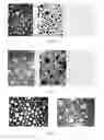 Fig. 06 - Methods, devices, systems and kits for preparing compositions for care and repair of varicose veins