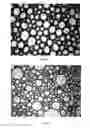Fig. 08 - Methods, devices, systems and kits for preparing compositions for care and repair of varicose veins
