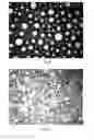 Fig. 09 - Methods, devices, systems and kits for preparing compositions for care and repair of varicose veins