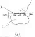 Fig. 05 - Wear-resistant roller