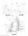 Fig. 17 - Pulp lifter