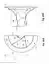 Fig. 43 - Pulp lifter