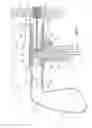 Fig. 02 - Hole cleaning apparatus and method