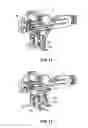 Fig. 06 - Twist application device with an adjustable distance between the conductor ends