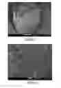 Fig. 08 - SUPERHARD STRUCTURE OR BODY COMPRISING A BODY OF POLYCRYSTALLINE DIAMOND CONTAINING MATERIAL