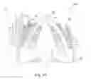 Fig. 15 - Tool handle for holding multiple tools of different sizes during use